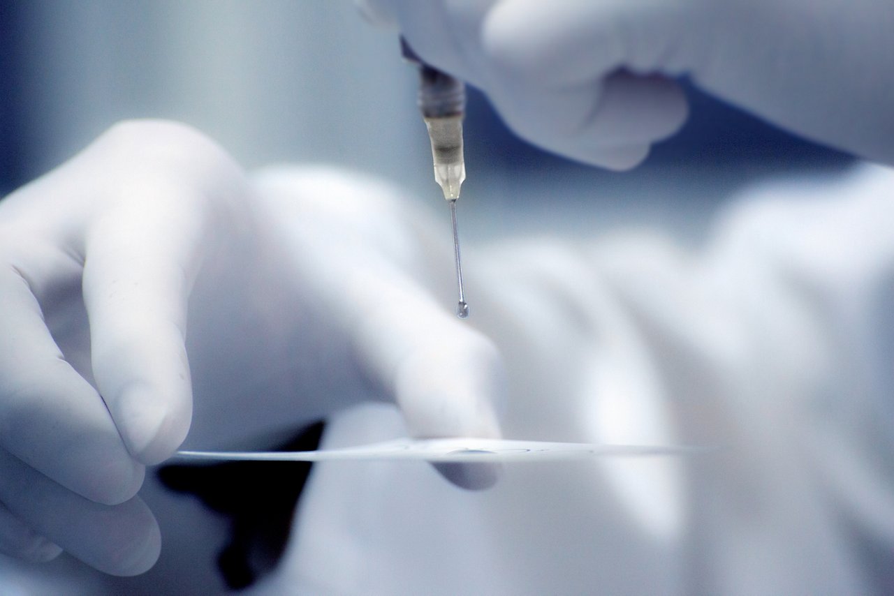 RPR, VDRL ,Syphilis test (motion blur,dark tone); Shutterstock ID 431167291; Purchase Order: N/A