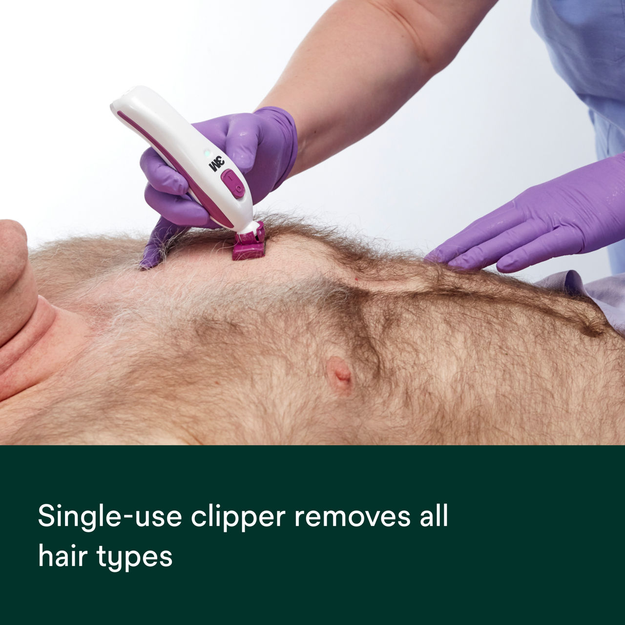 Single-use Pivoting Clipper Blade Assembly 9660 PDP Secondary Image 1