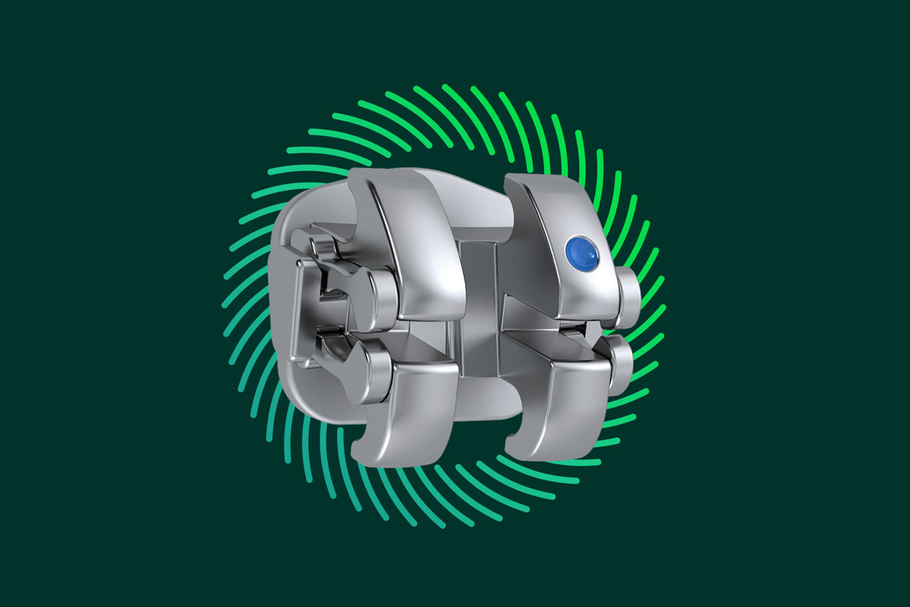 Transform smiles with clean, efficient brackets