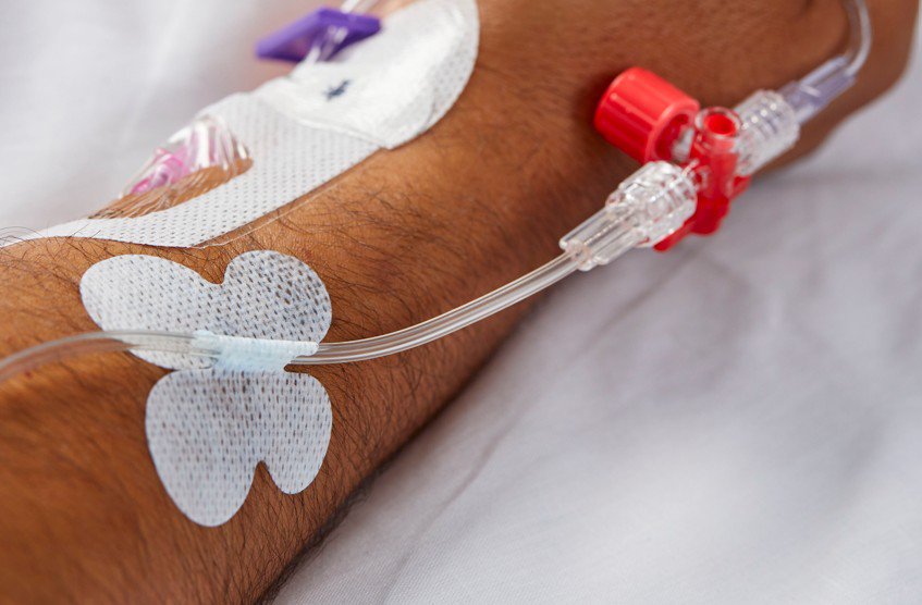 Paciente de 2025 ensaio fotográfico de estilo de vida TWSD com TSD Linha A no antebraço