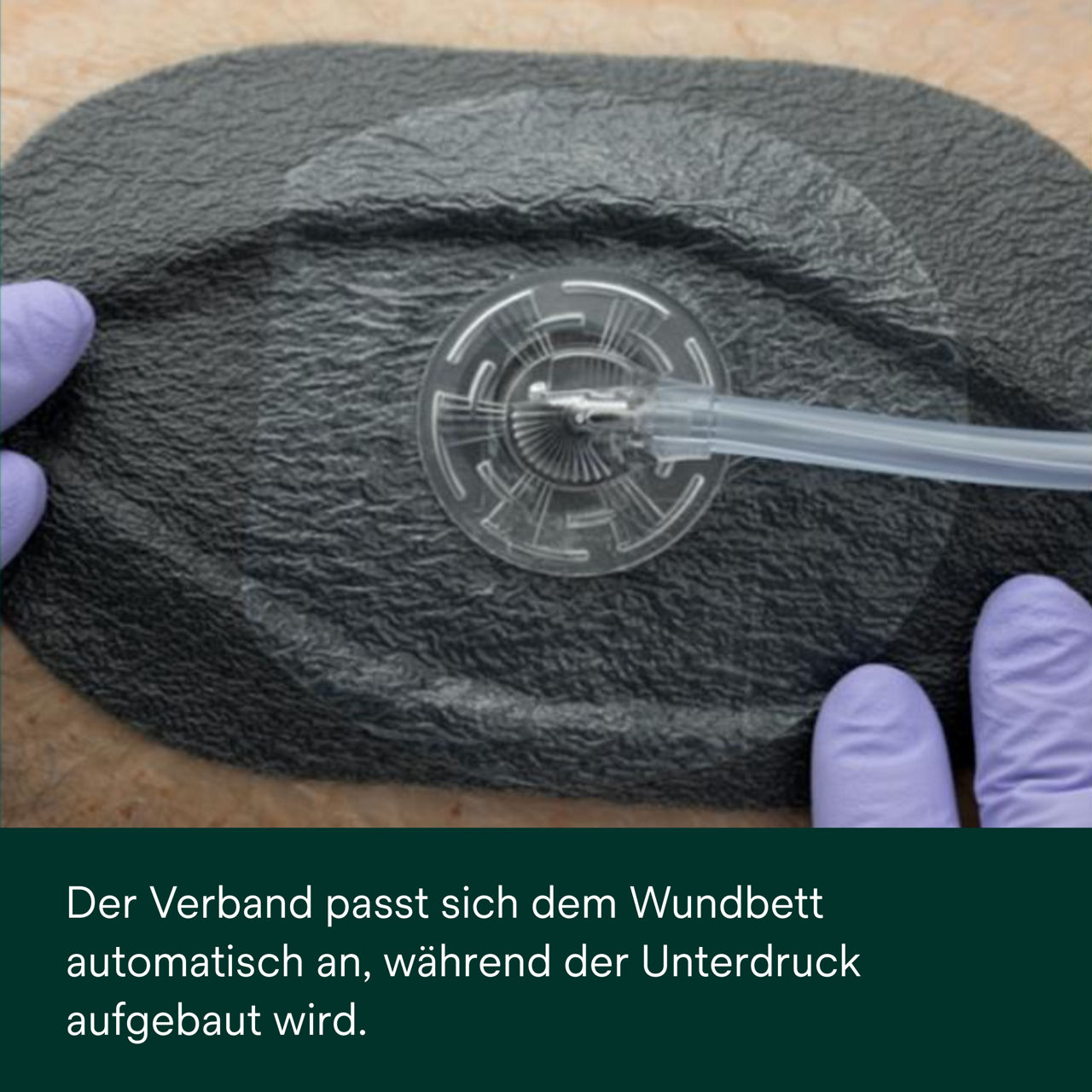 1: V.A.C. Peel and Place – Bedecken Sie das Wundbett und die Haut um die Wunde herum.