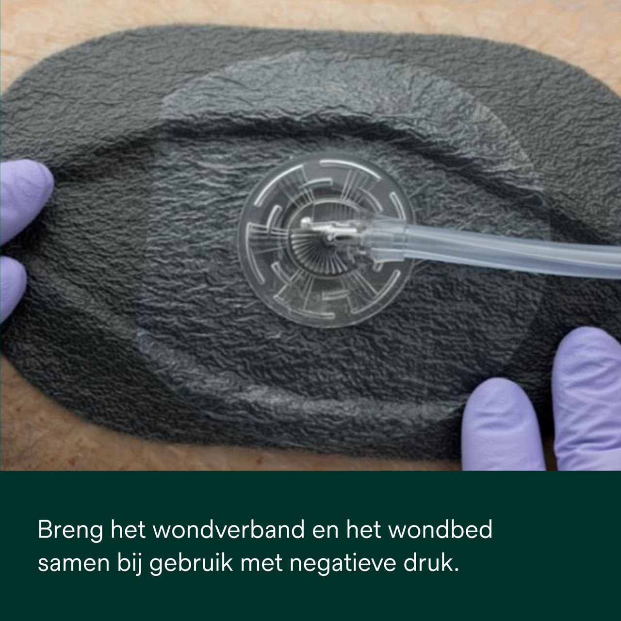 1: V.A.C. Peel and Place - Bedek het wondbed en de huid rondom de wond.