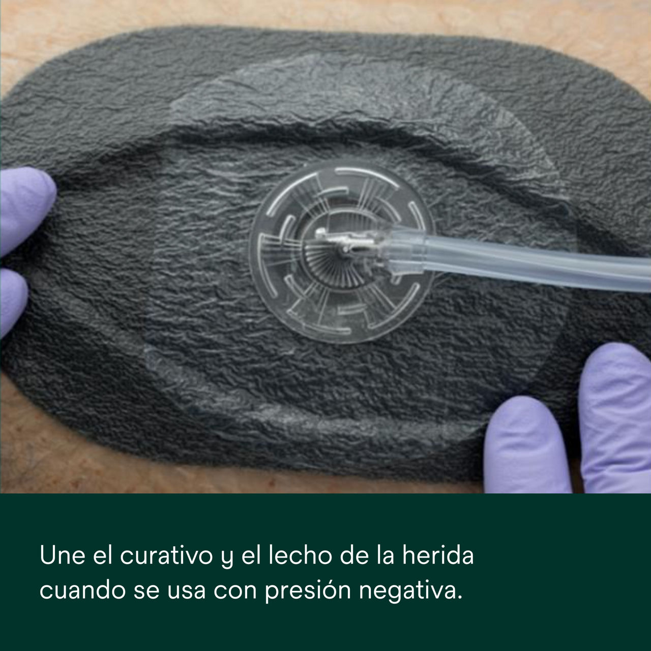 2: V.A.C. Peel and Place: junte el apósito y el lecho de la herida.