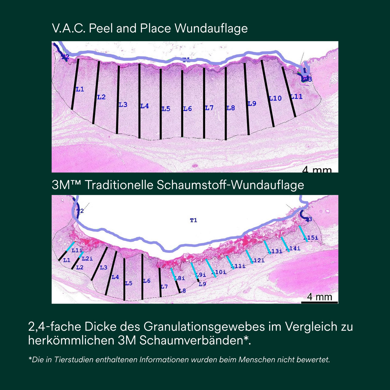 5: V.A.C. Peel and Place – Einfaches Anlegen in weniger als 2 Minuten