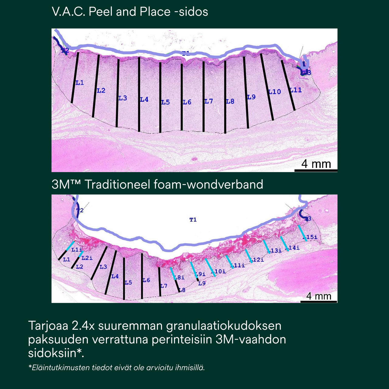 5: V.A.C. Peel and Place - Helppo kiinnittää alle 2 minuutissa