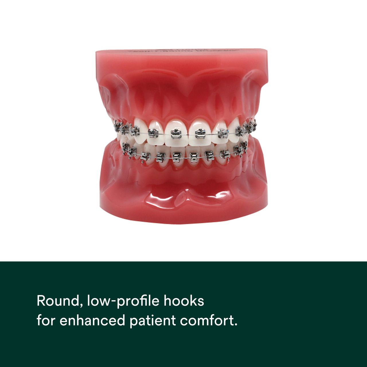 (3) Victory Series Active Self-Ligating Brackets: Round, low-profile hooks