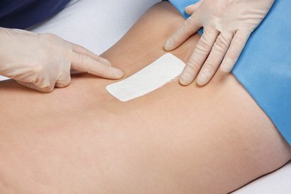 Um profissional médico usando luvas cirúrgicas aplica um 3M Tegaderm + Pad nas costas de uma mulher,